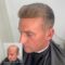 New hair replacement technology